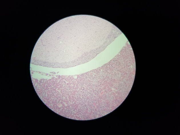 Pituitary Gland Slides - Pituitary Gland 003 100X